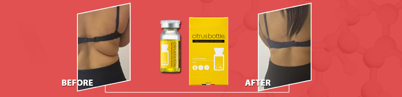 citrus bottle до и после